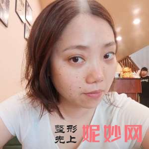 北京西美斯医疗美容诊所马勇光医生技术好不好_微晶磨削去法令纹技术好不好_坐诊时间
