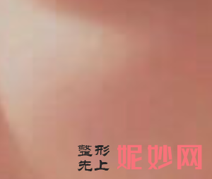 北京西美斯医疗美容诊所邓菲菲医生靠谱吗_玻尿酸填充泪沟靠谱吗