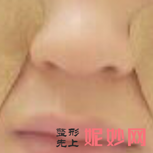 北京西美斯医疗美容诊所邓菲菲医生靠谱吗_玻尿酸填充泪沟靠谱吗