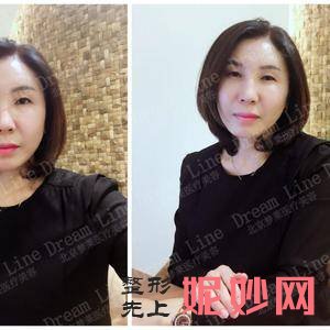 北京惠合嘉美医疗美容诊所陈旭医生技术好不好_巨乳缩小技术好不好_门诊时间表