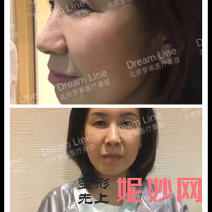 北京惠合嘉美医疗美容诊所陈旭医生技术好不好_巨乳缩小技术好不好_门诊时间表