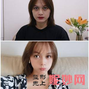 沈阳杏林整形外科医院朱铎鹏医生靠谱吗_牙齿不齐靠谱吗