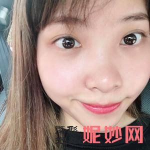 成都艾米丽医疗美容门诊部是正规医院吗?附2021较新整形案例