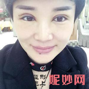 南京华美美容医院是正规医院吗?附2021较新整形案例