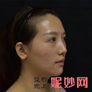 兰州皙妍丽医疗美容门诊部口碑怎么样？附2021年较新价格表