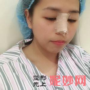 芜湖爱容整形医院邬鑫医生技术怎么样_爱贝芙注射技术怎么样_门诊时间表_案例分享