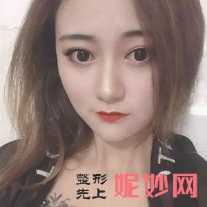 芜湖爱容整形医院吕睿紘医生技术好不好_朝天鼻矫正术技术好不好_门诊时间表