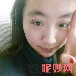 芜湖爱容整形医院谢小禹医生好不好_除皱针颏肌放松好不好_坐诊时间_案例分享