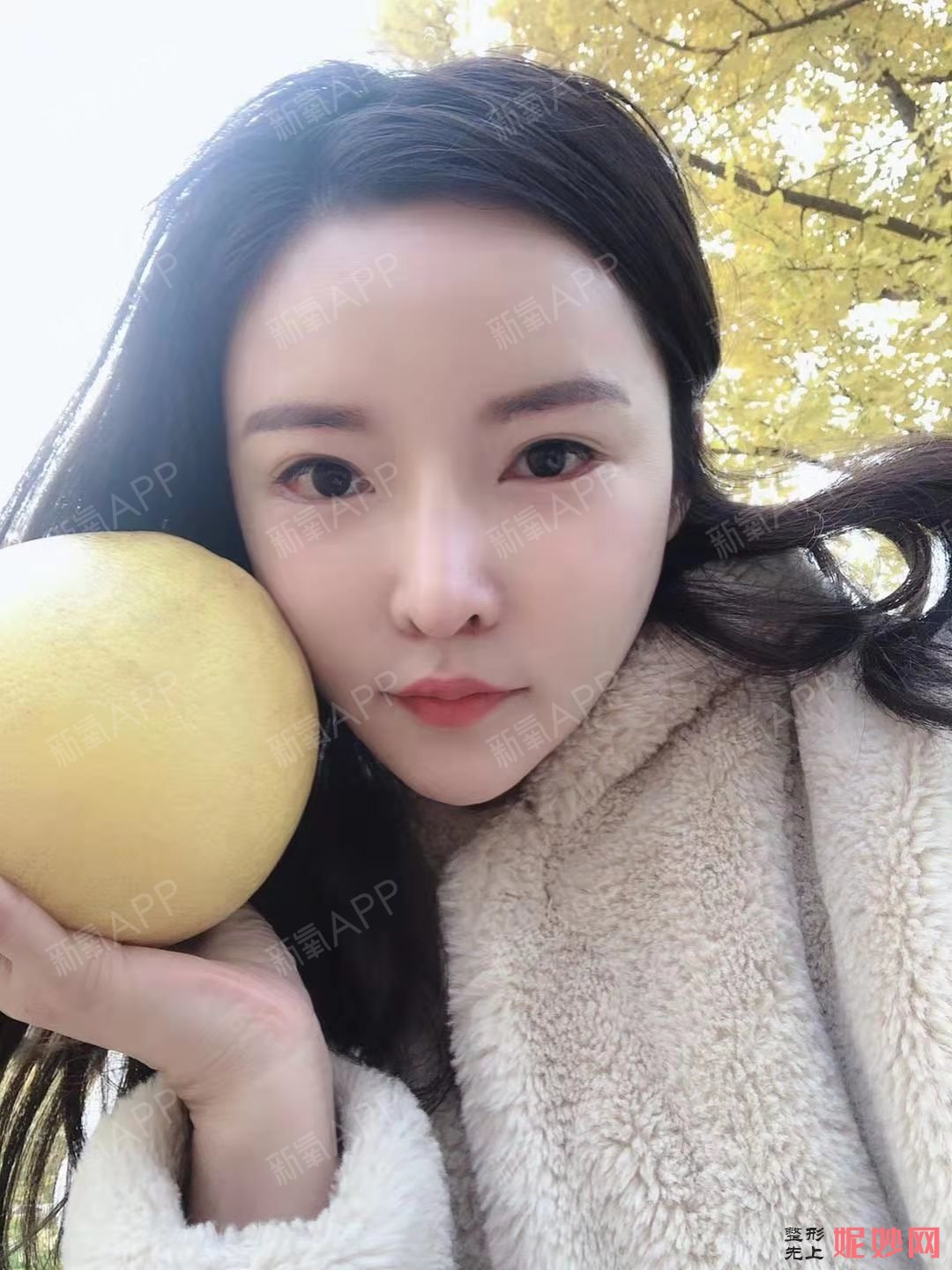 芜湖爱容整形医院谢小禹医生好不好_除皱针颏肌放松好不好_坐诊时间_案例分享