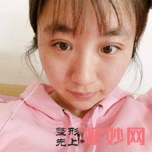 芜湖爱容整形医院谢小禹医生好不好_除皱针颏肌放松好不好_坐诊时间_案例分享