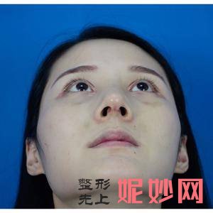 北京安贞医院激光整形科金燕医生怎么样_瘦腰腹怎么样_出诊时间