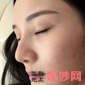 北京安贞医院激光整形科金燕医生怎么样_瘦腰腹怎么样_出诊时间