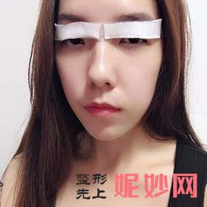 北京安贞医院激光整形科蒋建婷医生技术好不好_根管治疗技术好不好_出诊时间