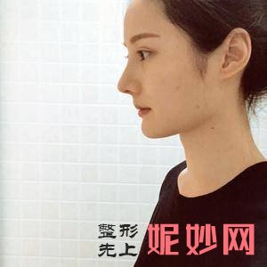 北京安贞医院激光整形科金燕医生怎么样_瘦腰腹怎么样_出诊时间