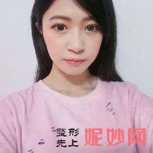 北京薇琳医疗美容医院董香君医生好不好_乳头内陷矫正好不好_坐诊时间_案例分享