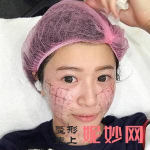 北京薇琳医疗美容医院董香君医生好不好_乳头内陷矫正好不好_坐诊时间_案例分享
