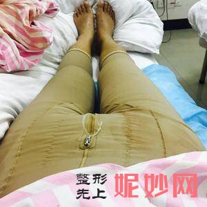 北京联合丽格较好整形医疗美容医院吴焱秋医生怎么样_膨体丰额头怎么样_门诊时间表_案例分享
