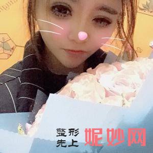 北京联合丽格较好整形医疗美容医院吴焱秋医生怎么样_膨体丰额头怎么样_门诊时间表_案例分享