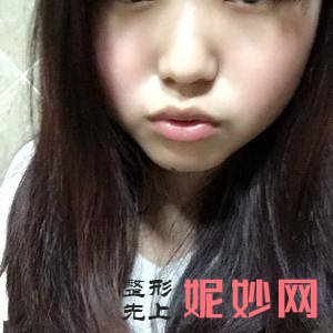 北京京城皮肤医院闫爱萍医生靠谱吗_背侧切口法治疗包茎靠谱吗_出诊时间