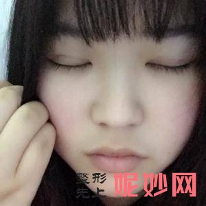 北京京城皮肤医院闫爱萍医生靠谱吗_背侧切口法治疗包茎靠谱吗_出诊时间
