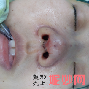 北医三院美容整形科是正规医院吗?