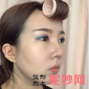 北医三院美容整形科是正规医院吗?
