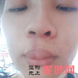 四川华美紫馨医学美容整形医院口碑怎么样？附2021年较新价格表