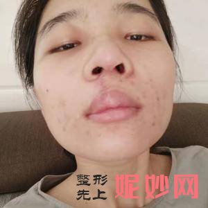 四川华美紫馨医学美容整形医院口碑怎么样？附2021年较新价格表