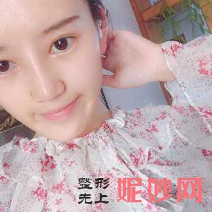 广州广大整形美容医院是正规医院吗?附2021较新整形案例