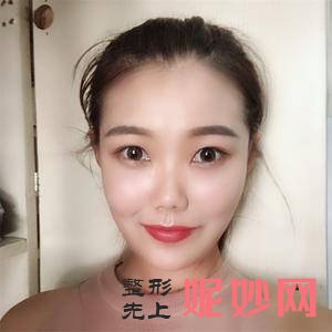 成都晶肤医疗美容整形医院是公立医院吗？附2021较新整形案例