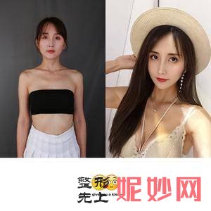 成都天使之翼整形美容医院是正规医院吗?
