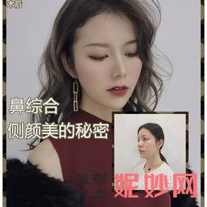 贵阳美莱医疗美容医院口碑怎么样？附2021年较新价格表