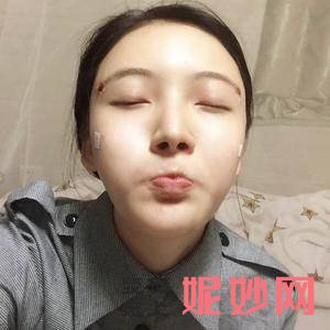 成都润美玉之光医疗美容整形门诊部是私立医院吗？附2021年较新价格表