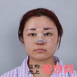 江苏省中医院整形外科怎么样?