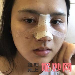 石河子大学医学院较好附属医院整形科是正规的吗?附2021较新整形案例