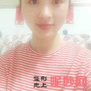 北京丽星翼美整形是公立医院吗？附2021年较新价格表
