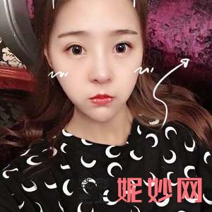 北京伟力嘉美信医疗美容是正规医院吗?附2021年较新价格表