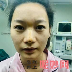 重庆华美整形美容医院怎么样?