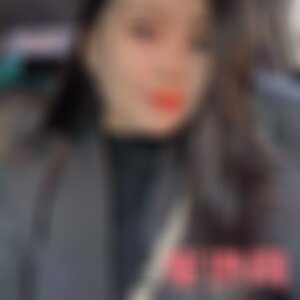 淮北微悦医疗美容口碑怎么样？