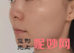 欧洲之星和7d哪个好？治疗后的效果怎么样？