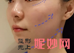 欧洲之星和7d哪个好？治疗后的效果怎么样？