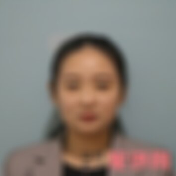 南京华美消脂针多少钱一针