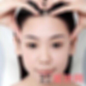 南京华美脱发际线多少钱