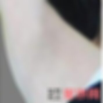 南京华美能做腋臭吗
