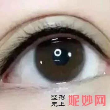 南京华美纹眼线多少钱