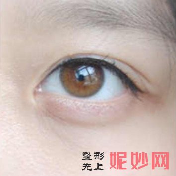 南京华美纹眼线多少钱