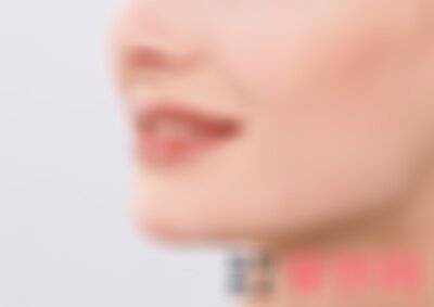 南京华美鼻综合多少钱