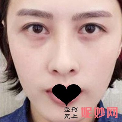 南京华美做植眉多少钱