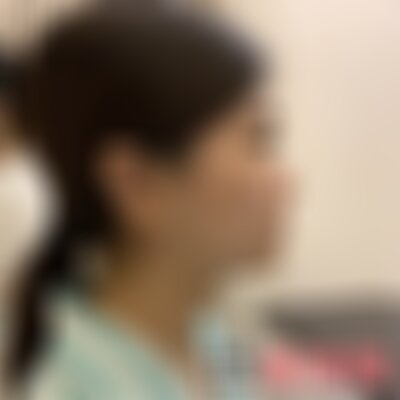 南京华美修复鼻子好吗