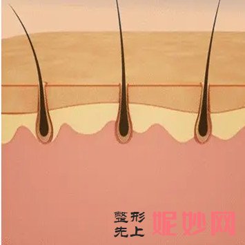 绵阳茗汇脱毛怎么样